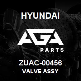 ZUAC-00456 Hyundai Construction VALVE ASSY | AGA Parts